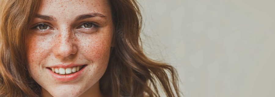 Control The Freckles On Your Skin | Reclaiming the Classroom